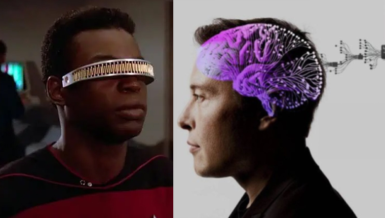 एलन मस्कको ब्रेनचिप स्टार्टअप न्युरालिङ्कले तयार,डिभाइस लगाएपछि आँखा देख्न सकिने !